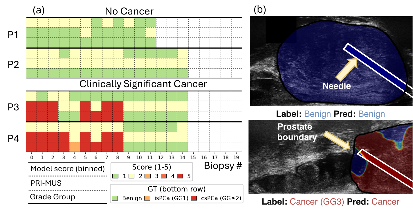 Compass risk scores and heatmaps across biopsy cores